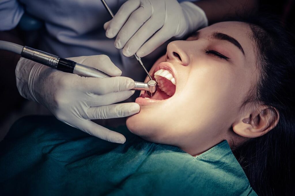 A fogszuvasodás kezelése legtöbbször a lyukas fog tömését jelenti.